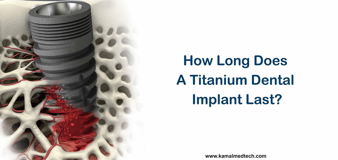 how-long-a-titanium-dental-implant-last
