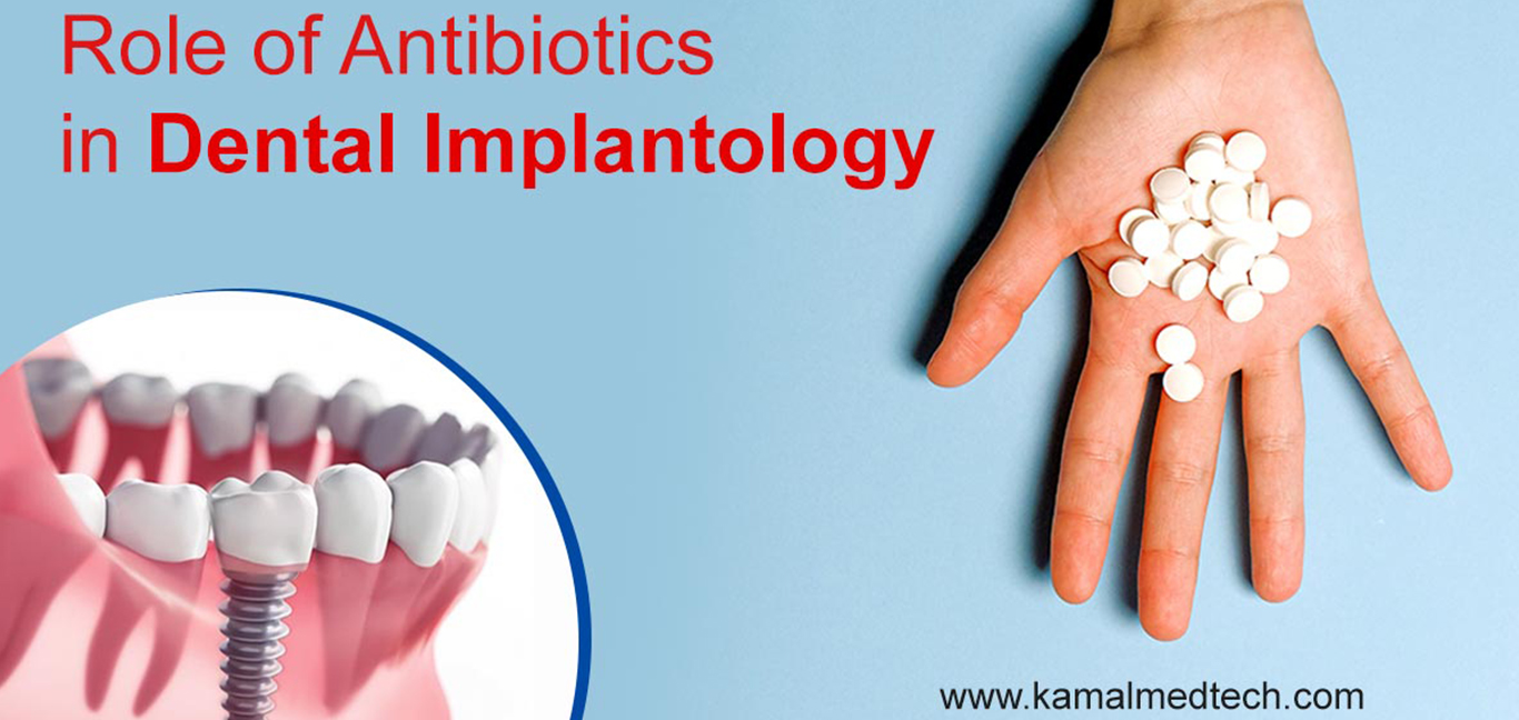antibiotics-use-in-dental-implant-success-and-failures